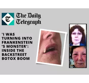 The Telegraph – ‘I was turning into Frankenstein’s monster’: Inside the backstreet Botox boom