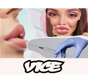 What We Learned from the UK’s Biggest Poll About Lip Fillers
