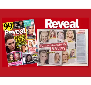 REVEAL MAGAZINE – BOTOX: IS IT WORTH THE RISK?