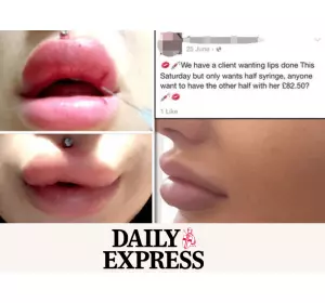 Save Face in the Express: REVEALED: Lip filler frenzy leaving teenage girls with HORRIFIC damage